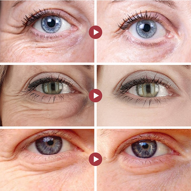 Creme para os Olhos Anti-rugas