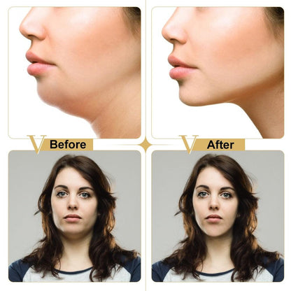 Máscara 4D Facial Lifting em Forma de V - Lindas & Cia Shop